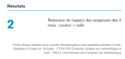 Bariéderm Cica-Huile soin dermatologique Uriage - flacon de 100 ml