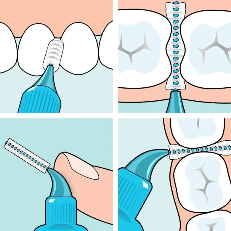 Brossettes interdentaires originales bleu taille 3 (0.6 mm) TePe