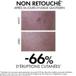 Capital Soleil UV-Clear Fluide anti-imperfections SPF50+ Vichy - flacon-pompe de 40 ml