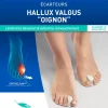 Ecarteurs Hallux Valgus Epitact - 2 unités