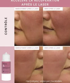Enoxolone Hyper-réactivité cutanée Etat Pur - flacon de 15ml