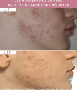 Enoxolone Hyper-réactivité cutanée Etat Pur - flacon de 15ml