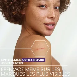 Epitheliale Ultra repair HA+ Crème réparatrice anti-marques A-Derma
