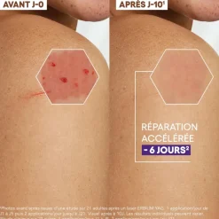 Epitheliale Ultra repair HA+ Crème réparatrice anti-marques A-Derma