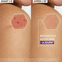 Epitheliale Ultra repair HA+ Crème réparatrice anti-marques A-Derma