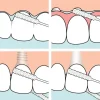 Fil dentaire spécial implants TePe - boite de 30 pièces