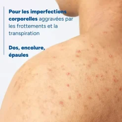 Keracnyl spray corps asséchant anti-boutons Ducray - spray de 150ml