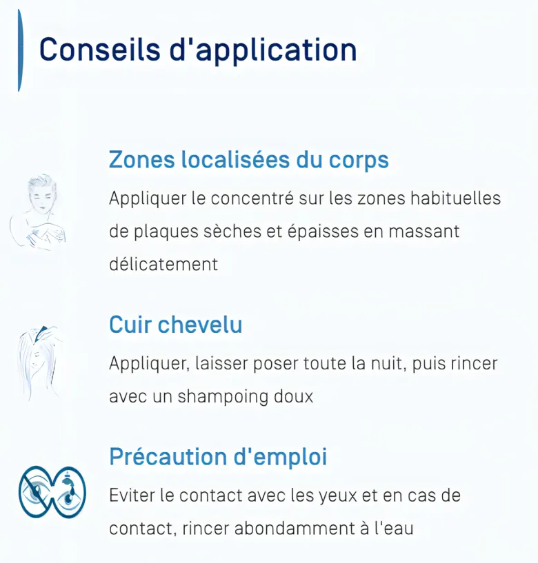 Kertyol PSO concentré Ducray – usage local, tube 100 ml