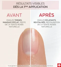 Nail Corrector Booster éclat biopeptides Poderm - flacon de 8ml