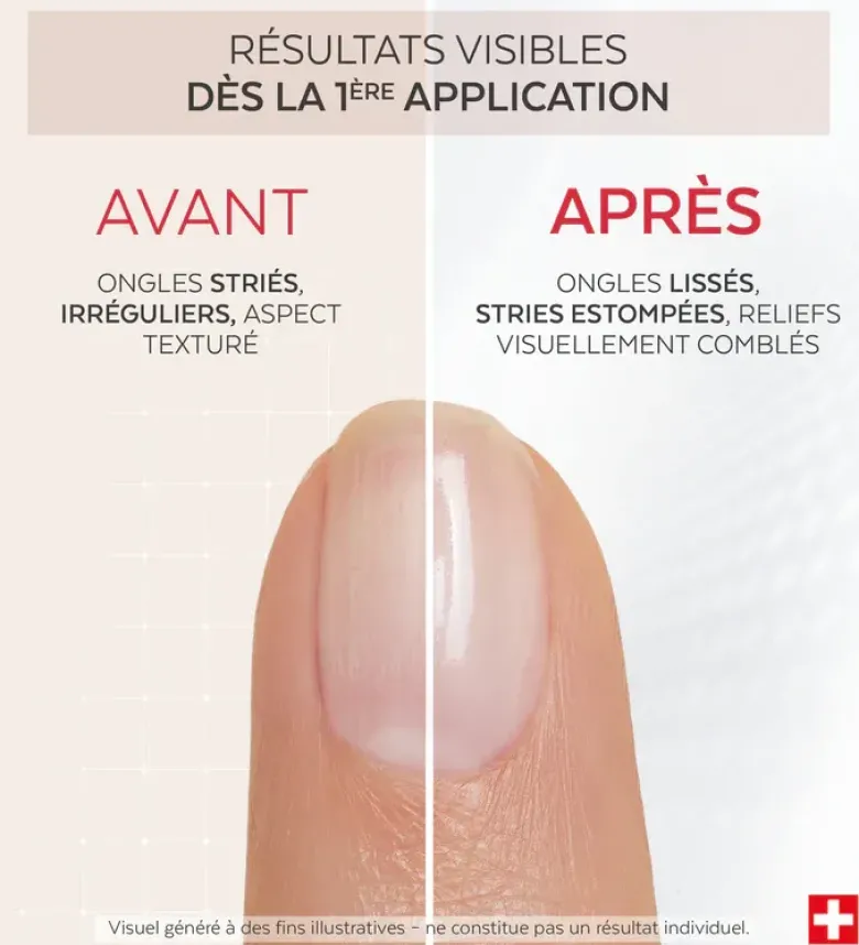 Nail Corrector Comblant Collagène Poderm - flacon de 8ml