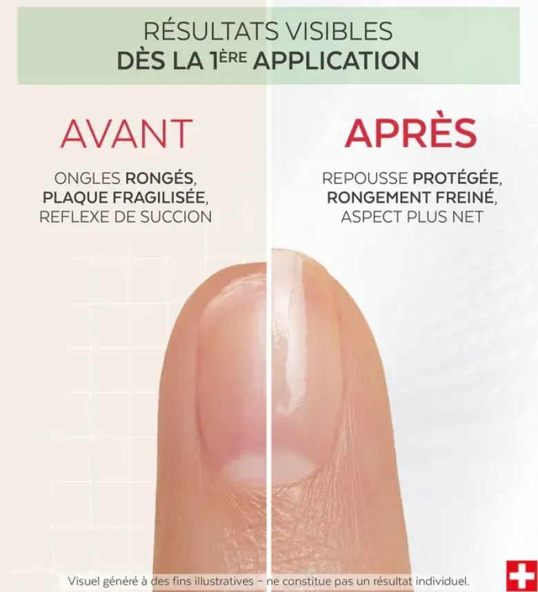 Nail Corrector Vernis amer Protéines de pois Poderm - flacon de 8ml
