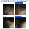 Phytophanère Antichute réactionnelle Phyto - boite de 12 ampoules de 5ml