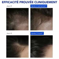 Phytophanère Antichute réactionnelle Phyto - boite de 12 ampoules de 5ml