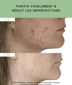 Propolis teint brouillé peau à tendance acnéique Etat Pur - flacon de 15ml