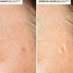Protectoderm anti-taches Lescuyer - boîte de 60 gélules