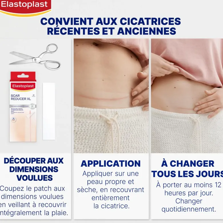 Réducteur de cicatrices Elastoplast - boite de 21 patchs