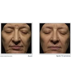 Rétinol avancé correction rides crème nuit RoC - tube de 30ml