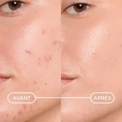 Sébium kerato + cover gel-crème anti-imperfections Bioderma - tube de 30ml