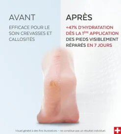 Sérum pieds crevasses et callosités Poderm - flacon-pompe de 75ml