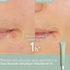 Vinopure Stop boutons salicylique Caudalie - tube de 15ml